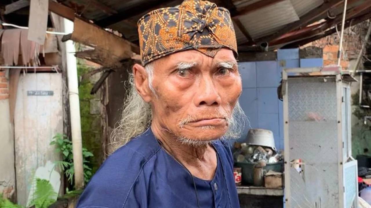 Diding Boneng Sempat Tak Bisa Bernapas, Asma Kambuh hingga Dilarikan ke RS